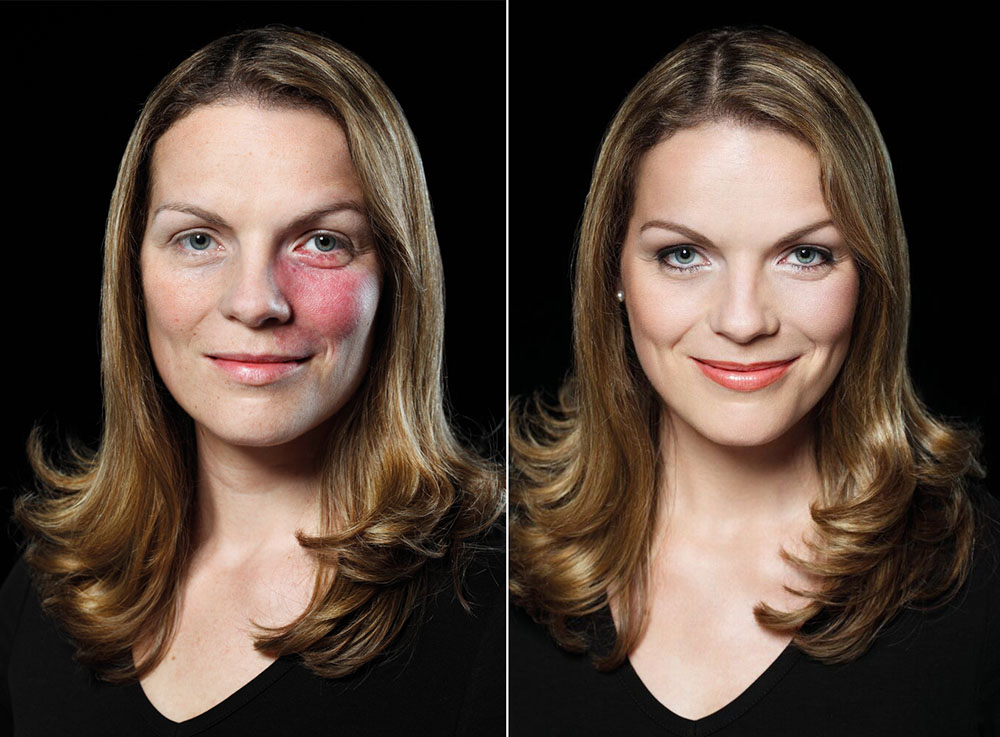 תוצאות קאמופלאג' לפני ואחרי